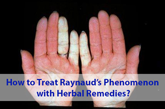 Raynauds Phenomenon