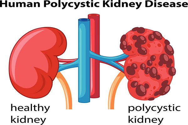  kidney health