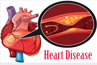 How Ayurveda Treats Ischemic Heart Disease? - Consultant Portal