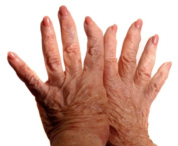 scleroderma and skin problems