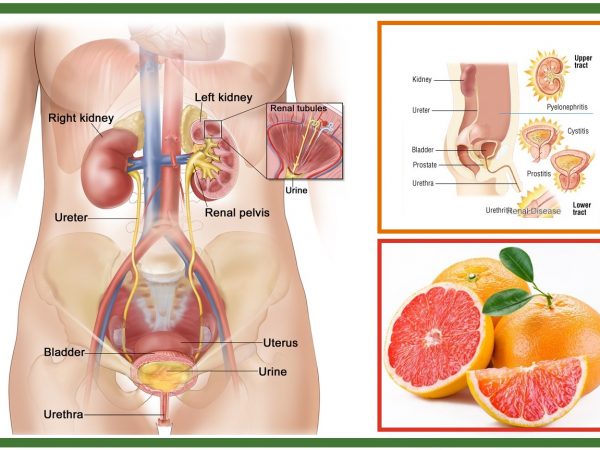 Herbal Remedies for Urinary tract infections