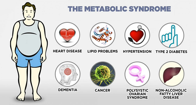 Heart disease,hypertension,cancer metabolic syndrome,  X syndrome,
Polysystic ovarian syndrome,