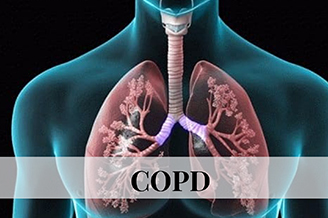 herbs useful in copd Archives - AyuCliniko | Optimum Health Begins Here