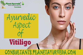 How Vitiligo Can Be Treated In Ayurveda Archives - AyuCliniko | Optimum ...