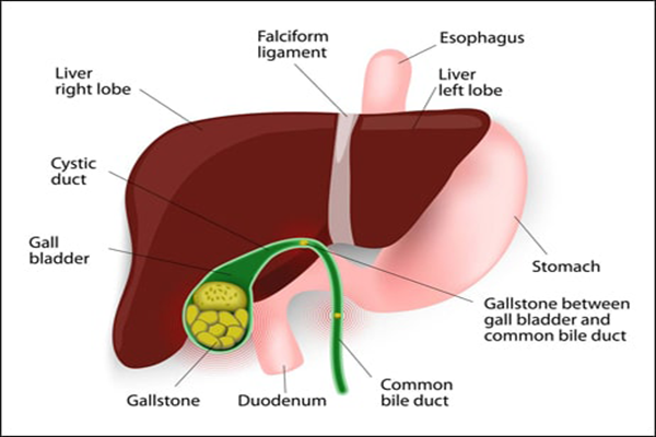 Amazing Kitchen Remedies for Gallstone