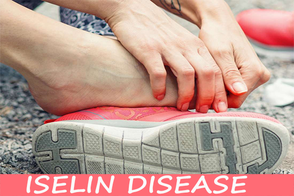 How Iselin Disease Can Be Cured?