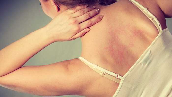 Different types of allergies